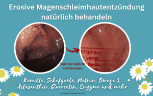 Erosive Magenschleimhautentzündung