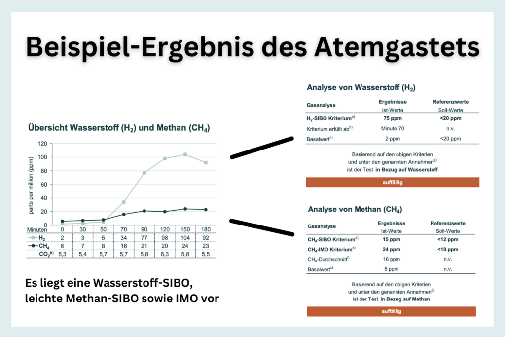 SIBO Diagnostik und Behandlung