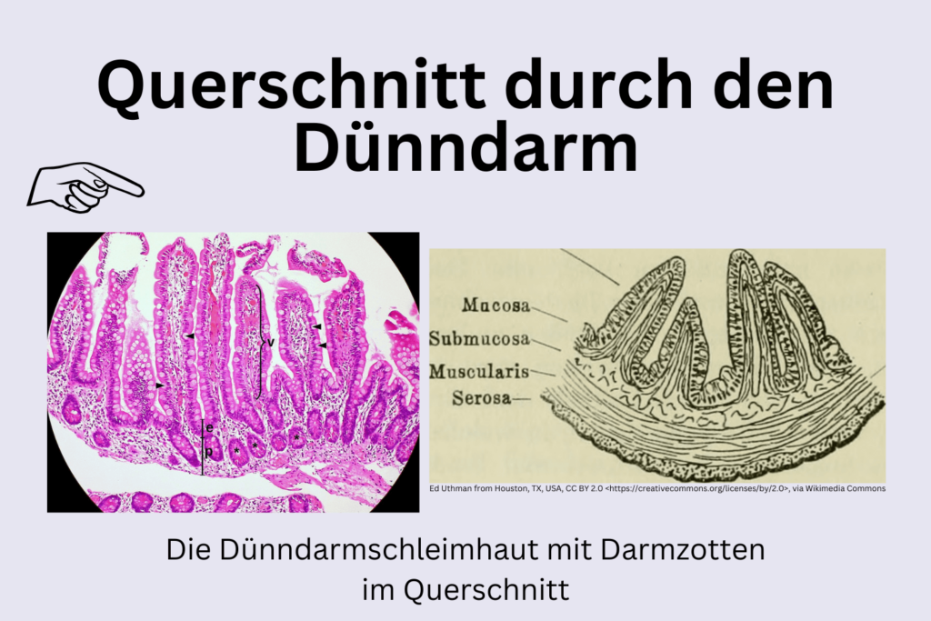 SIBO_Dünndarm_Querschnitt